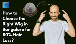 How to Choose the Right Wig in Bangalore for 80% Hair Loss?